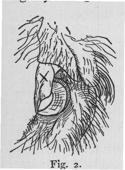 drawn through, the comb on one side